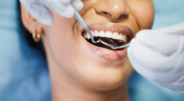 Best Knocked-Out Tooth Emergency  in Miami Heights, OH